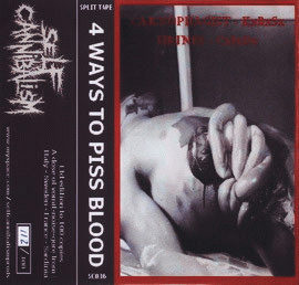 Congenital Interior Defects : 4 Ways to Piss Blood